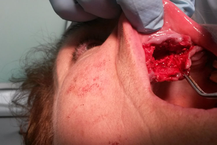 mouth-surgery2.jpg